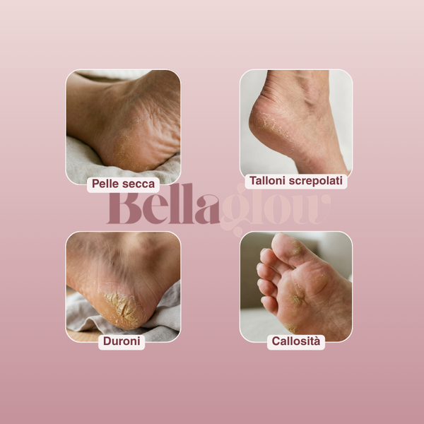 Dove le creme falliscono, il Pedi Glow agisce.