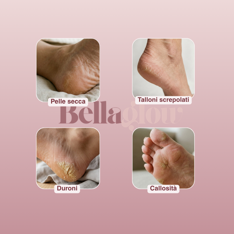 Dove le creme falliscono, il Pedi Glow agisce.